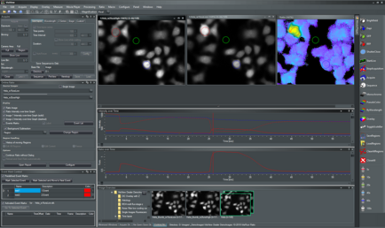 Ratio Imaging Fura\/FRET